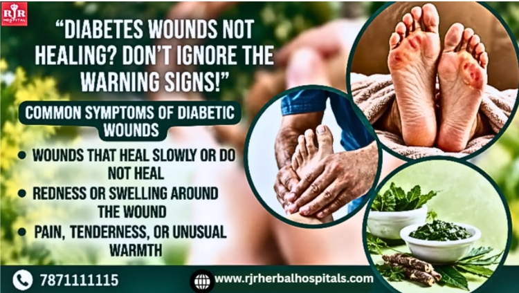 Diabetic Wound Treatment in Chennai: Care and Treatment Options